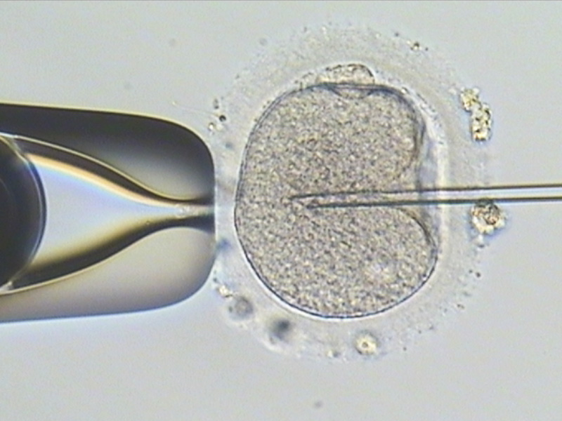 单一精虫显微授精术-安安试管婴儿中心,不孕症,试管婴儿,人工受孕,冷冻卵子