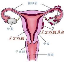子宫内膜异位症-安安试管婴儿中心,不孕症,试管婴儿,人工受孕,冷冻卵子