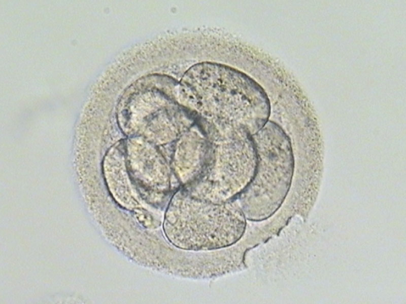 镭射胚胎孵育术 (L-AH)
