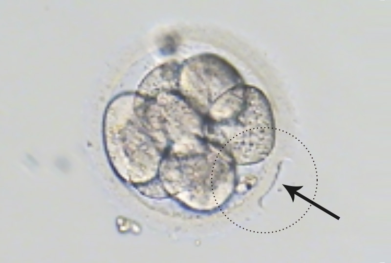  镭射胚胎孵育术
