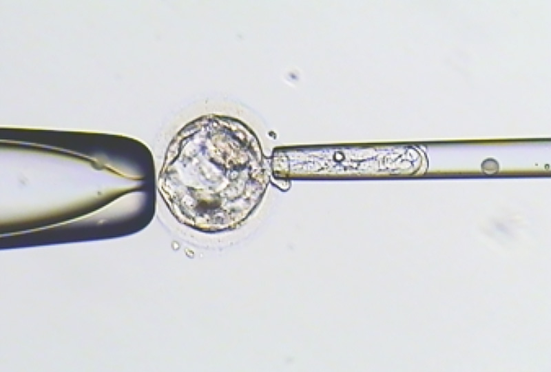 胚胎着床前染色体筛检