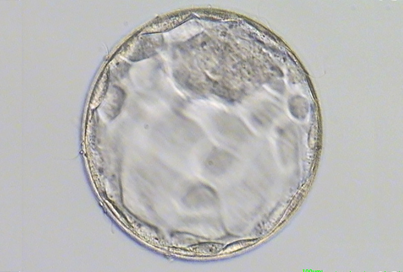  囊胚期胚胎培养